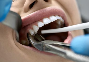 Dhinakaran Dental Clinic – Leading Dentist in Meenakshipuram, Nagercoil