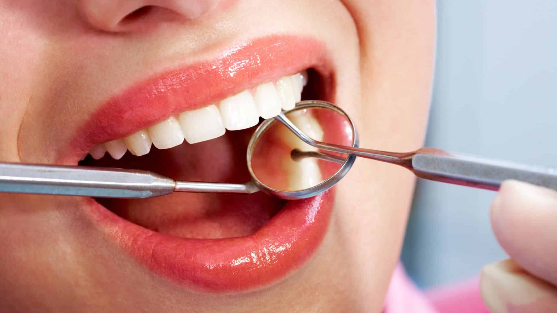 Best dental clinic in Nagercoil offering root canal, braces, cosmetic dentistry and child dental care