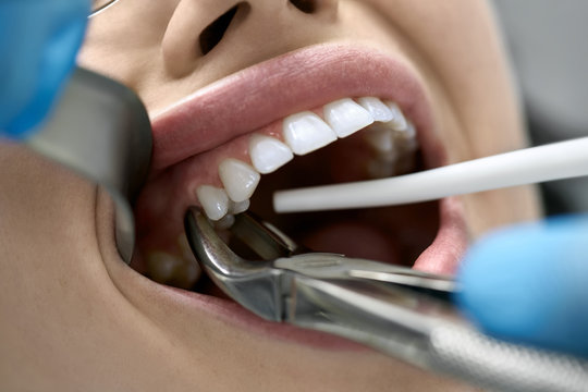 Dhinakaran Dental Clinic – Leading Dentist in Meenakshipuram, Nagercoil
